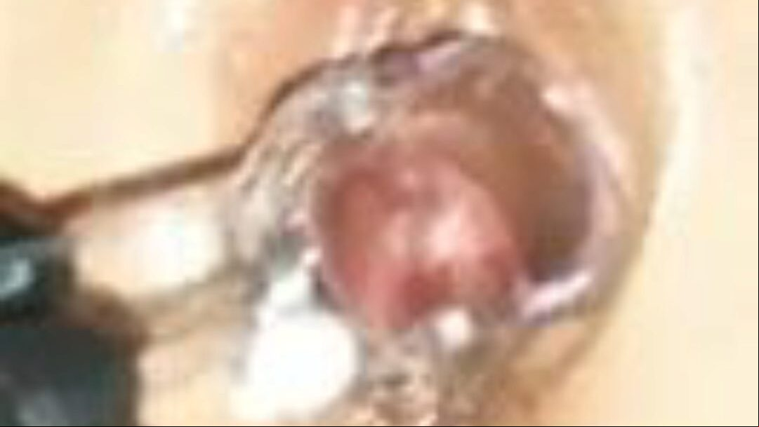 martinaheela milf med stor kusse og spekulum fingerede ur martinaheela mor, jeg vil gerne kneppe med stor kusse og spekulum fingerede filmscene på xhamster - den ultimative skønhed af gratis danske fremmede gonzo pornografi tube episoder